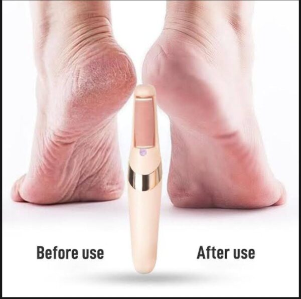Rechargeable Electric Foot File Callus Remover Pedicure Machine for Heels Grinding